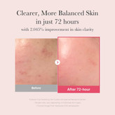 MediCube Niacinamide Serum — سرم نیاسینامید مدیکیوب برای کنترل چربی، کاهش جوش و روشنکننده پوست